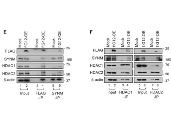 Immunoprecipitation using TrueBlot Anti-Mouse IgG