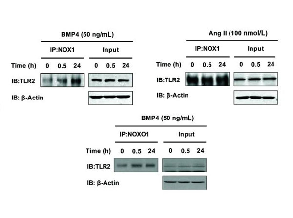 Immunoprecipitation using TrueBlot Anti-Goat