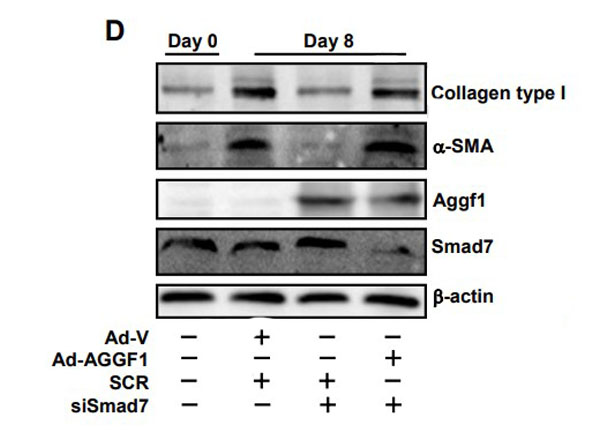 Western Blot results using Bovine Collagen Type I