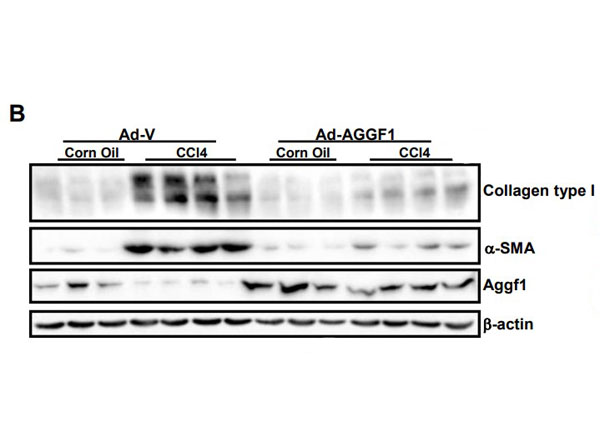 Western Blot results using Bovine Collagen Type I