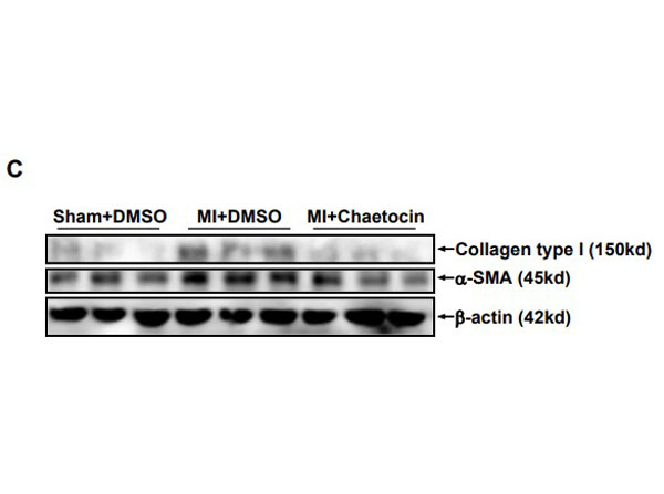 Western Blot results using Bovine Collagen Type I