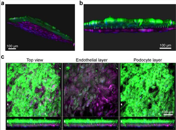 Immunofluorescent using Human albumin Texas Red