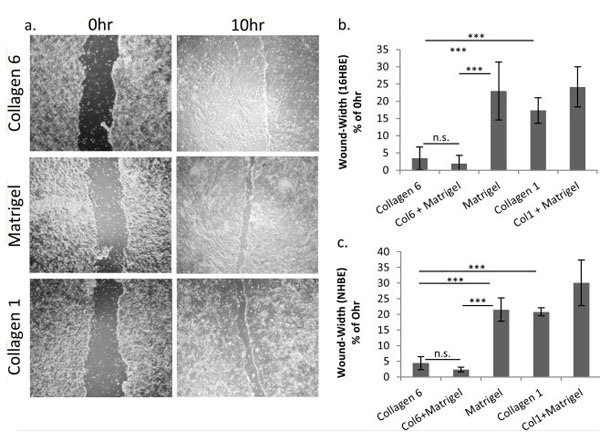 2D culture using Human Collagen Type VI