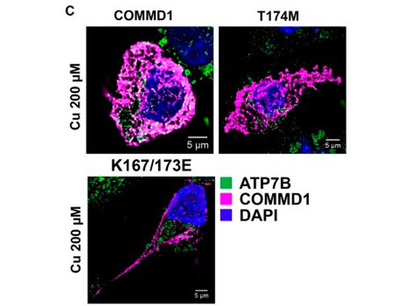 Immunofluorescence using Transferin Rhodamine