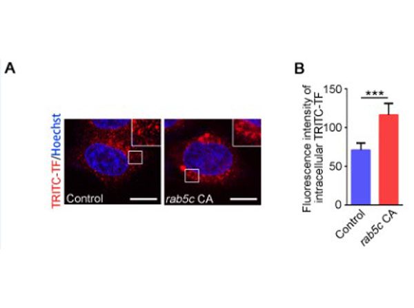Immunofluorescence using Transferin Rhodamine