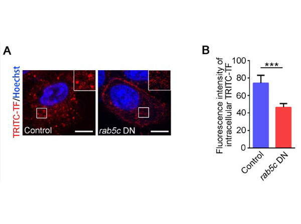 Immunofluorescence using Transferin Rhodamine
