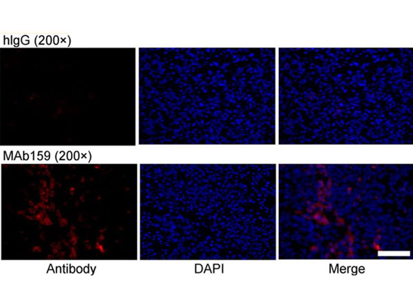 Immunofluorescence using Human IgG