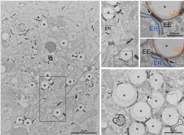 Electron Microscopy using Human Transferrin HRP