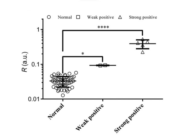 Lateral Flow using Rabbit IgG
