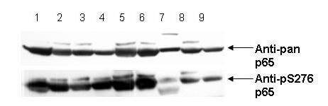 Western Blot - Anti-NFKB p65 (Rel A) pS276 Antibody