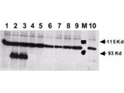 Anti-Human NOTCH 1 (Cleaved N Terminal) Antibody - Western Blot