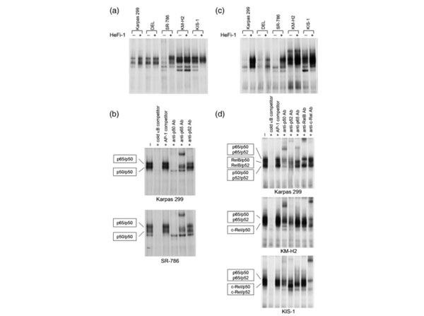 EMSA results using Anti-NFKB p52