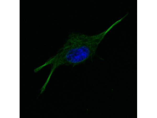 Immunofluorescence microscopy of Anti-tubulin