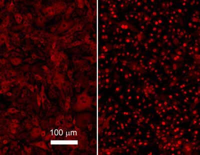 Anti-NFKB p65 (Rel A) Antibody - Immunofluorescence Microscopy