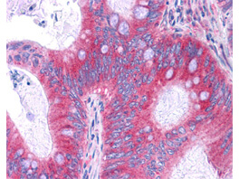 Anti-NFKB p65 (Rel A) Antibody – Immunohistochemistry