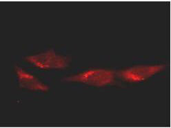 p53 Antibody - Immunofluorescence Microscopy