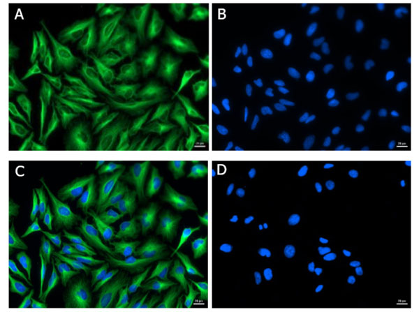 Immunofluorescence of Mouse Anti-Alpha Tubulin Antibody