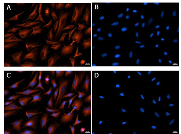 Immunofluorescence of Mouse Anti-Alpha Tubulin Antibody