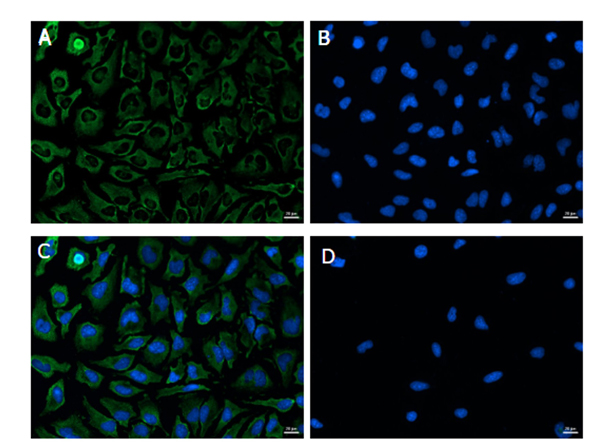 Immunofluorescence of GAPDH