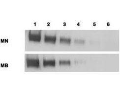 Anti-Mesothelin Antibodies - Western Blot