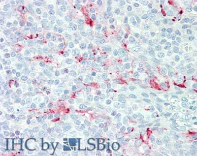 Immunohistochemistry of Mouse anti-Mesothelin antibody