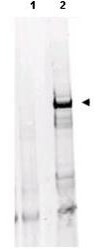 Anti-ATM Monoclonal Antibody - Western Blot