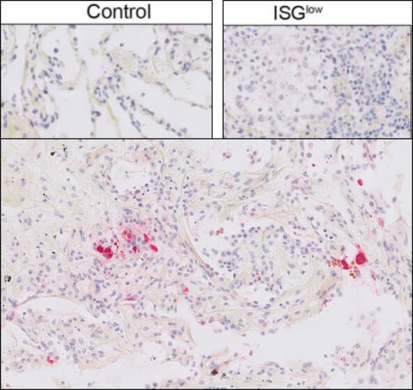 Immunohistochemistry of Rabbit Anti-SARs CoV Nucleocapsid Antibody