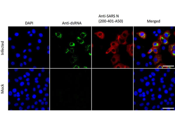 Immunofluorescence assay using Rabbit Anti-SARS-CoV Nucleocapsid (N) Antibody