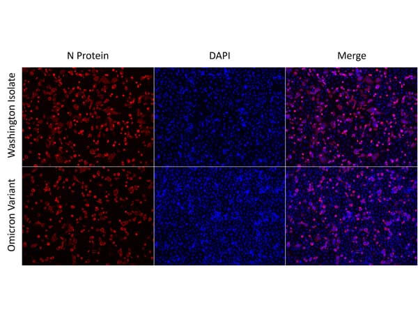 Immunofluorescence of Anti-SARS CoV Nucleocapsid