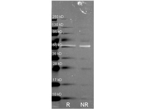Anti Catalase Polyclonal Antibody-Western blot