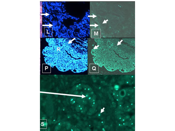 FISH using Goat Anti-FITC