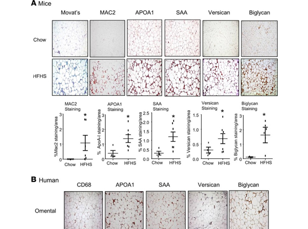 Immunohistochemistry of Anti-Apolipoprotein AI