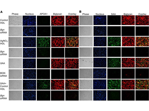 Immunofluorescence of Anti-Apolipoprotein AI