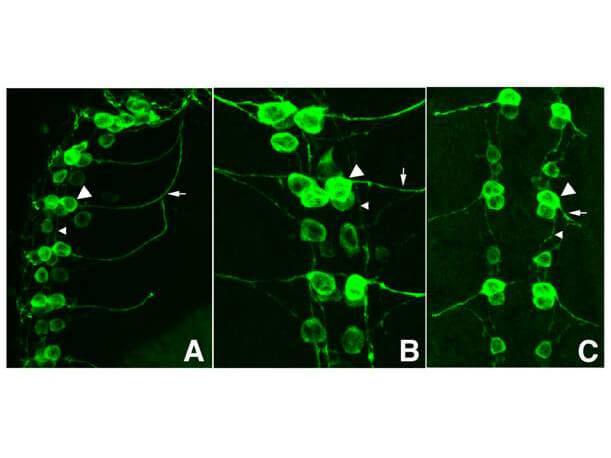 Immunofluorescence - Anti-GFP Antibody