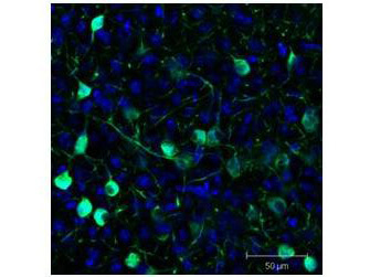 Immunofluorescence - Anti-GFP Antibody