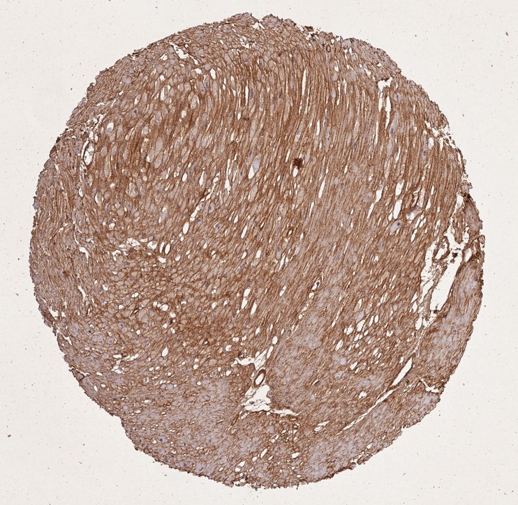 Immunohistochemistry of Rabbit Anti-Collagen Type I