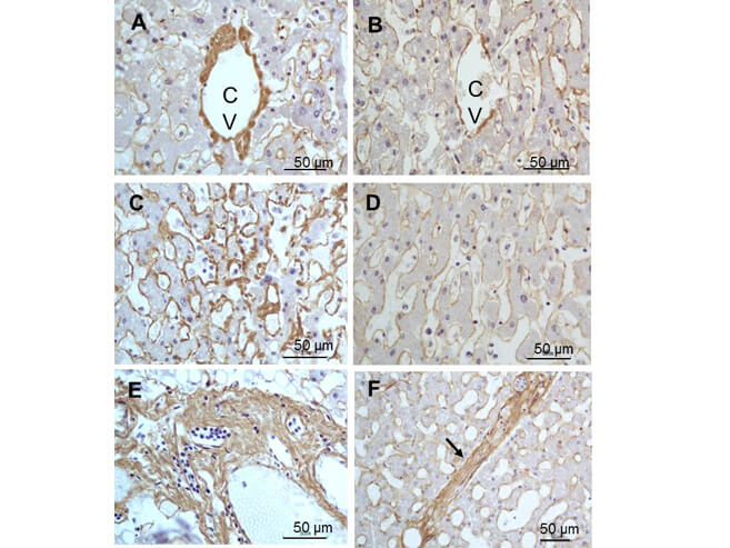 Immunohistochemistry - Anti-Collagen III