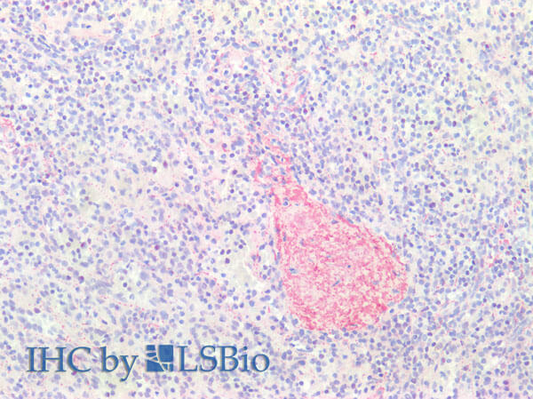 Immunohistochemistry of Anti-Collagen Type III Antibody