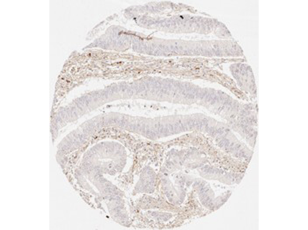Immunohistochemistry of Rabbit Anti-Collagen Type III