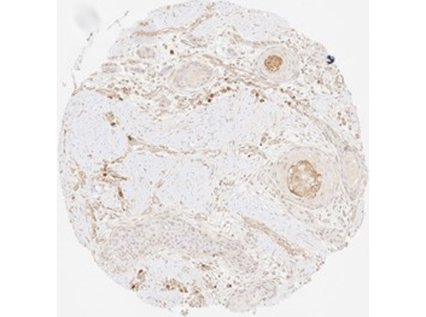 Immunohistochemistry of Rabbit Anti-Collagen Type III