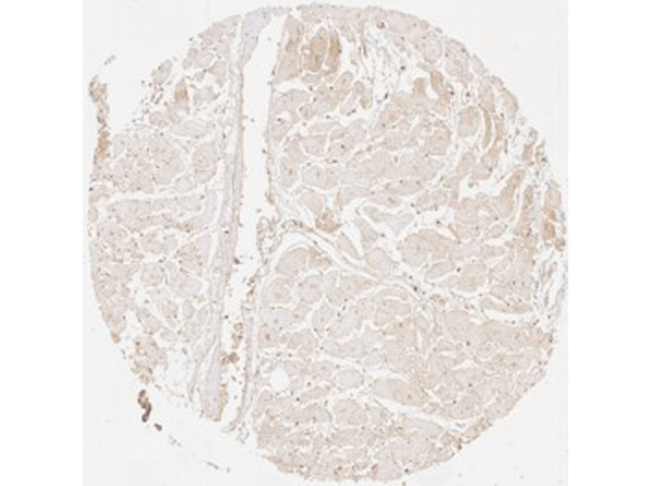 Immunohistochemistry of Rabbit Anti-Collagen Type III