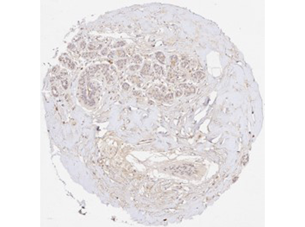 Immunohistochemistry of Rabbit Anti-Collagen Type III