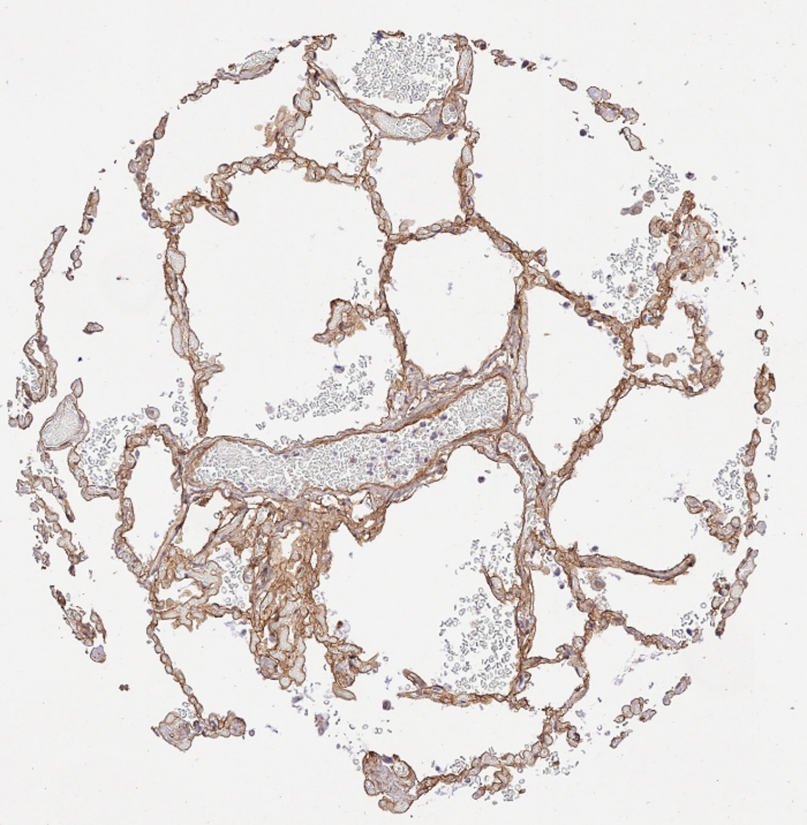 Immunohistochemistry of Rabbit Anti-Collagen Type IV