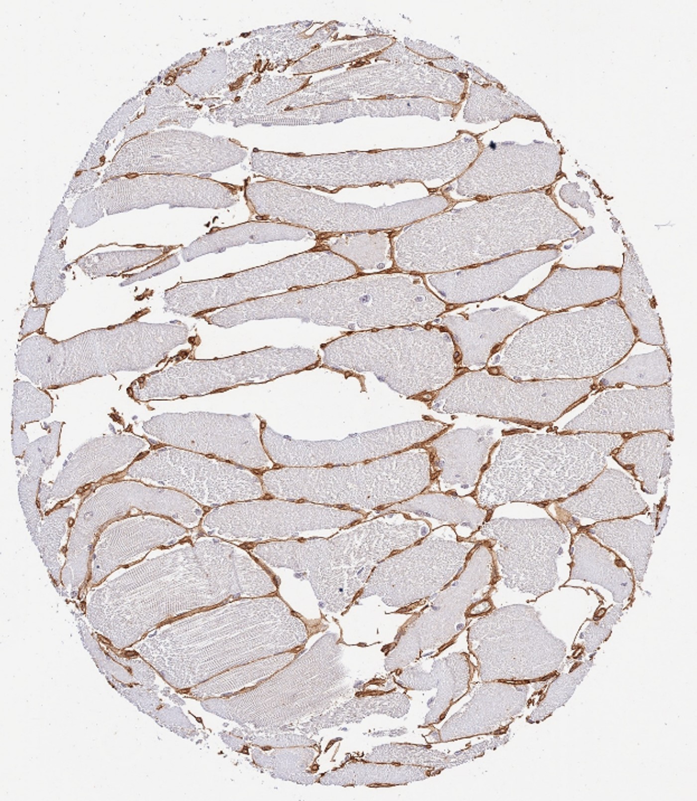 Immunohistochemistry of Rabbit Anti-Collagen Type IV