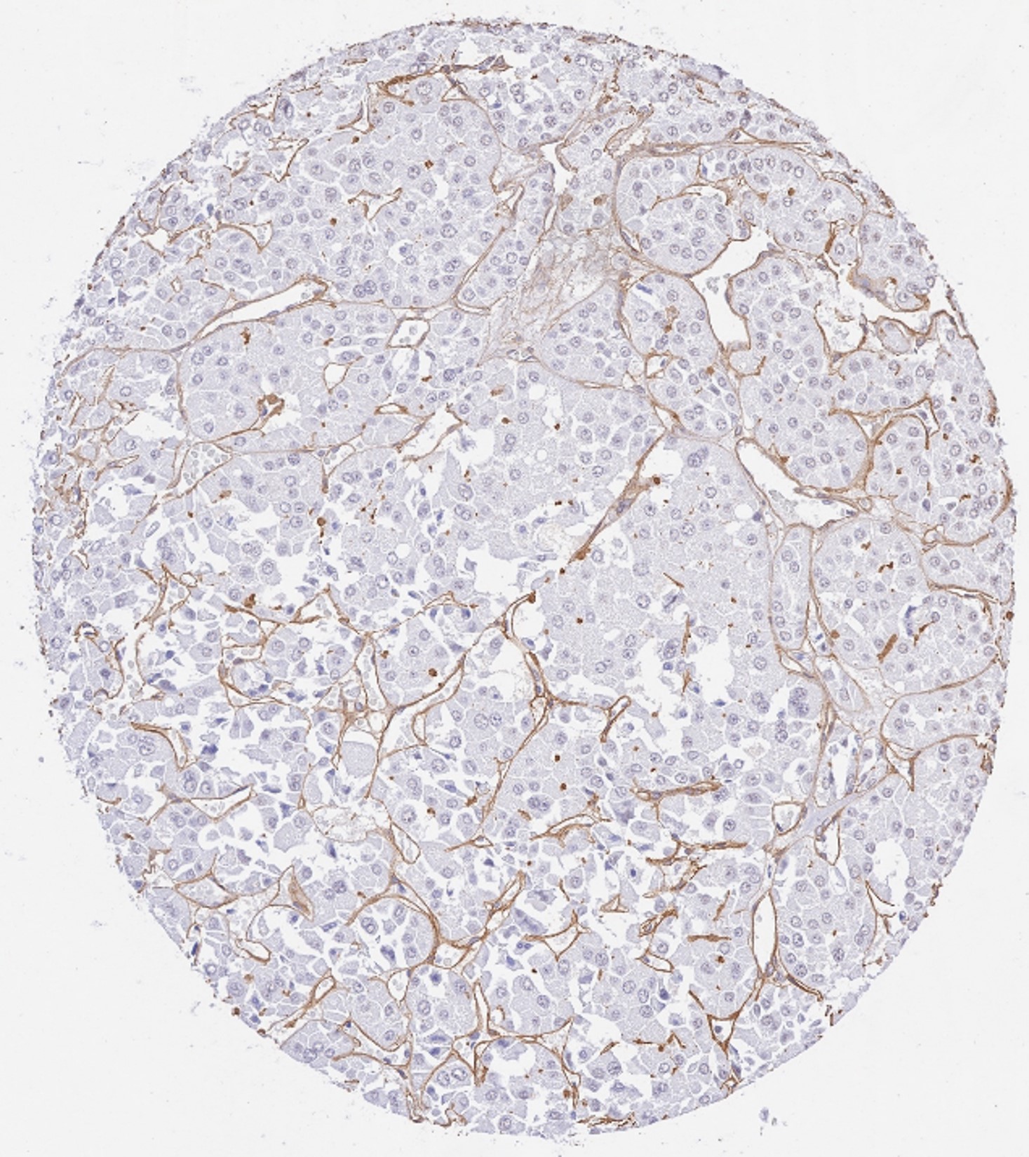 Immunohistochemistry of Rabbit Anti-Collagen Type IV
