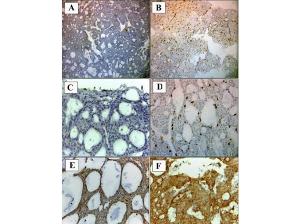 Immunohistochemistry using Telomerase catalytic subunit Antibody