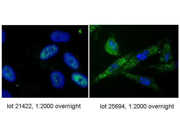 Anti-hTERT Antibody - Immunofluorescence Microscopy