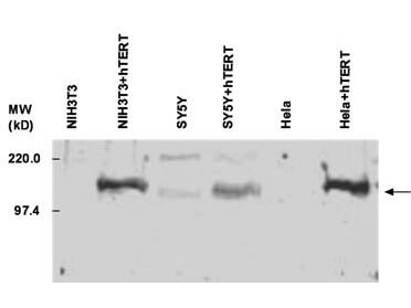 Anti-hTERT Anitbody - Western Blot