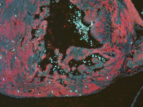 Immunofluorescence Microscopy - Anti-RFP antibody