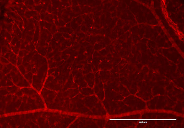 Immunofluorescence Microscopy of Rabbit Anti-RFP antibody.